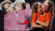 Montagem de Abby e Brittany na infância e em foto recente - Divulgação / Vídeo / OWN